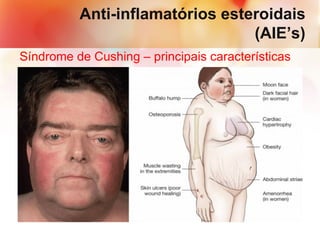 Anti-inflamatórios esteroidais
(AIE’s)
Síndrome de Cushing – principais características
• Metabolismo de lipídeos: Redistribuição da gordura
corporal (aumento de ácidos graxos no plasma); aumento
da gordura na parte posterior do pescoço (giba de búfalo),
área supra clavicular e face (face de lua-cheia).
• Síndrome de Cushing.
 