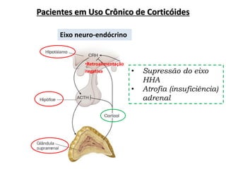 Eixo neuro-endócrino
•Retroalimentação
negativa
Pacientes em Uso Crônico de Corticóides
• Supressão do eixo
HHA
• Atrofia (insuficiência)
adrenal
 