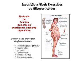Exposição a Níveis Excessivos
de Glicocorticóides
Rang et al., 2003. Farmacologia, 5a ed.
Síndrome
de
Cushing
(tumores da
suprarrenal, adenoma
hipófisário)
Excesso e uso prolongado
de glicocorticóides
 Redistribuição de gordura;
 Hipertensão;
 Miopatia;
 Osteoporose;
 Diabetes melitus;
 Imunossupressão.
 