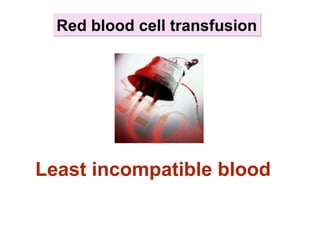 Red blood cell transfusionRed blood cell transfusion
Least incompatible blood
 