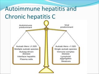 Autoimmune hepatitis and
Chronic hepatitis C
 