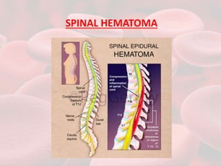 SPINAL HEMATOMA
 