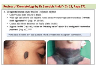 Re ie of Dermatology by Dr Saurabh Jindal - Ch 13, Page 271
 