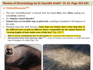 Re ie of Dermatology by Dr Saurabh Jindal - Ch 15, Page 323-324
 