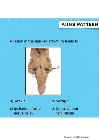 AIIMS Pattern Questions