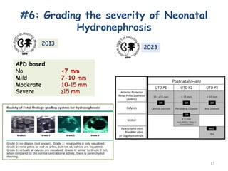 aiims ppt.pdf9999999999999999999999999999 | PDF