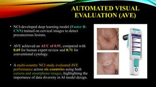 AUTOMATED VISUAL
EVALUATION (AVE)
• NCI-developed deep learning model (Faster R-
CNN) trained on cervical images to detect
precancerous lesions.
• AVE achieved an AUC of 0.91, compared with
0.69 for human expert review and 0.71 for
conventional cytology.
• A multi-country NCI study evaluated AVE
performance across six countries using both
camera and smartphone images, highlighting the
importance of data diversity in AI model design.
 