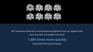 MIT researchers describe a machine-learning algorithm that can register brain
scans and other 3-D images more than
1,000 times more quickly
using novel learning techniques.
 