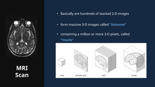 MRI
Scan
• Basically are hundreds of stacked 2-D images
• form massive 3-D images called “Volumes”
• containing a million or more 3-D pixels, called
“Voxels”
 