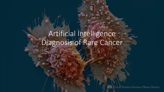 AI	Saves	Woman’s	Life
Eye of Science/Science Photo Library
Artificial	Intelligence	
Diagnosis	of	Rare	Cancer
 