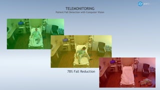 Patient Fall Detection with Computer Vision
TELEMONITORING
78% Fall Reduction
 