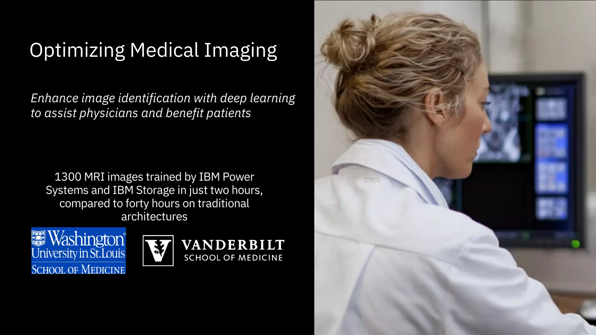 Optimizing Medical Imaging
Enhance image identification with deep learning
to assist physicians and benefit patients
1300 MRI images trained by IBM Power
Systems and IBM Storage in just two hours,
compared to forty hours on traditional
architectures
 