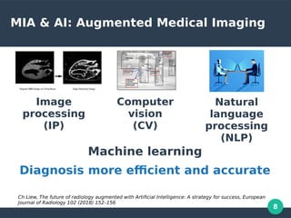 8
MIA & AI: Augmented Medical Imaging
Image
processing
(IP)
Computer
vision
(CV)
Natural
language
processing
(NLP)
Machine learning
Diagnosis more efficient and accurate
Ch Liew, The future of radiology augmented with Artificial Intelligence: A strategy for success, European
Journal of Radiology 102 (2018) 152–156
 