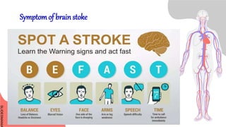 SLIDESMANIA
SLIDESMANIA
Symptom of brain stoke
 