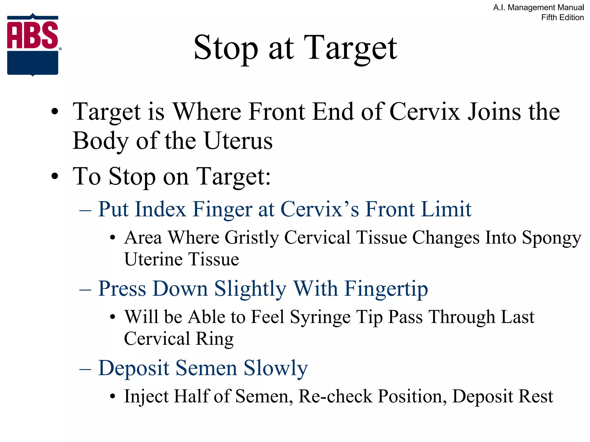 Stop at Target Target is Where Front End of Cervix Joins the Body of the Uterus To Stop on Target: Put Index Finger at Cervix’s Front Limit Area Where Gristly Cervical Tissue Changes Into Spongy Uterine Tissue Press Down Slightly With Fingertip Will be Able to Feel Syringe Tip Pass Through Last Cervical Ring Deposit Semen Slowly Inject Half of Semen, Re-check Position, Deposit Rest 