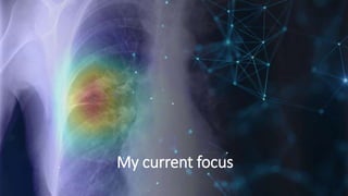 My current focus
 