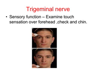Aim –Examination of cranial nerve.ppt