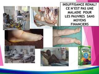 INSUFFISANCE RENAL?
CE N’EST PAS UNE
MALADIE POUR
LES PAUVRES SANS
MOYENS
FINANCIERS
 