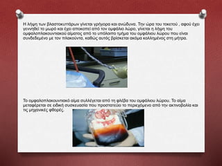 Η λήψη των βλαστοκυττάρων γίνεται γρήγορα και ανώδυνα. Την ώρα του τοκετού , αφού έχει
γεννηθεί το μωρό και έχει αποκοπεί από τον ομφάλιο λώρο, γίνεται η λήψη του
ομφαλοπλακουντιακού αίματος από το υπόλοιπο τμήμα του ομφάλιου λώρου που είναι
συνδεδεμένο με τον πλακούντα, καθώς αυτός βρίσκεται ακόμα κολλημένος στη μήτρα.
Το ομφαλοπλακουντιακό αίμα συλλέγεται από τη φλέβα του ομφάλιου λώρου. Το αίμα
μεταφέρεται σε ειδική συσκευασία που προστατεύει το περιεχόμενο από την ακτινοβολία και
τις μηχανικές φθορές.
 