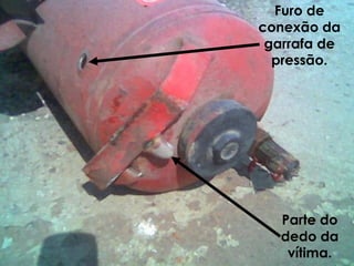Furo de
conexão da
garrafa de
pressão.
Parte do
dedo da
vítima.
 