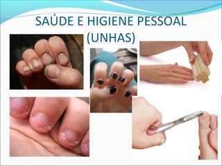 SAÚDE E HIGIENE PESSOAL 
(UNHAS) 
 