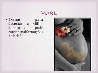 VDRL 
• Exame para 
detectar a sífilis, 
doença que pode 
causar malformações 
no bebê 
 