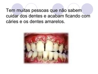 Tem muitas pessoas que não sabem cuidar dos dentes e acabam ficando com cáries e os dentes amarelos. 
