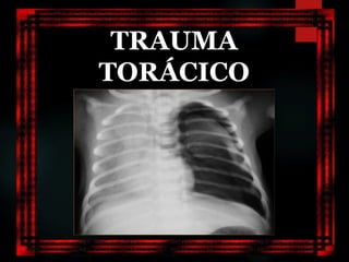 TRAUMA
TORÁCICO
 