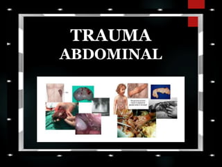 TRAUMA
ABDOMINAL
 