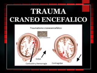 TRAUMA
CRANEO ENCEFALICO
 