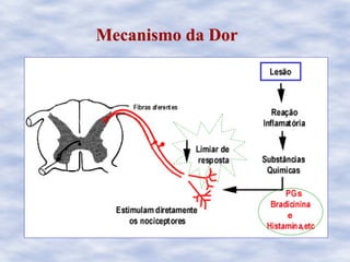 Mecanismo da DorMecanismo da Dor
e
s
 