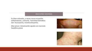 REACCIONES ADVERSAS
 