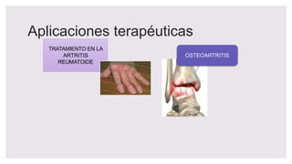 Aplicaciones terapéuticas
TRATAMIENTO EN LA
ARTRITIS
REUMATOIDE
OSTEOARTRITIS
 