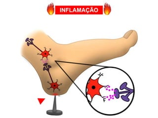 INFLAMAÇÃO
 
