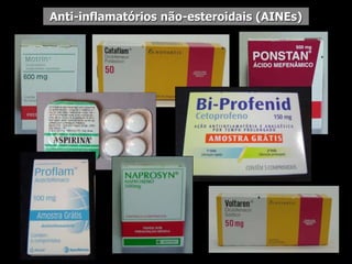 Anti-inflamatórios não-esteroidais (AINEs)
 