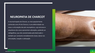 A neuroartropatia de Charcot, ou mais popularmente
conhecida como Pé de Charcot, é uma deformidade nos
ossos e articulações dos pés neuropáticos, cuja estrutura e
arquitetura dos ossos apresentam alterações, podendo ser
radiográficas, que são caracterizadas pela destruição e
também por constante remodelamento ósseo, danos nas
articulações, luxação e subluxação.
NEUROPATIA DE CHARCOT
Adicionar um rodapé 30
 
