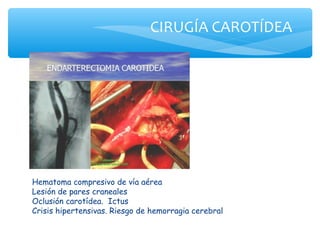 CIRUGÍA CAROTÍDEA




Hematoma compresivo de vía aérea
Lesión de pares craneales
Oclusión carotídea. Ictus
Crisis hipertensivas. Riesgo de hemorragia cerebral
 