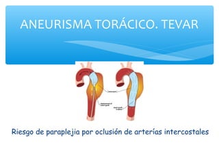 ANEURISMA TORÁCICO. TEVAR




Riesgo de paraplejia por oclusión de arterías intercostales
 