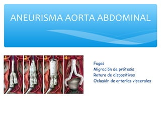 ANEURISMA AORTA ABDOMINAL



              Fugas
              Migración de prótesis
              Rotura de dispositivos
              Oclusión de arterías viscerales
 