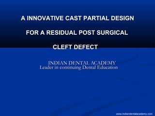 A INNOVATIVE CAST PARTIAL DESIGN
FOR A RESIDUAL POST SURGICAL
CLEFT DEFECT
INDIAN DENTAL ACADEMYINDIAN DENTAL ACADEMY
Leader in continuing Dental EducationLeader in continuing Dental Education
www.indiandentalacademy.com
 