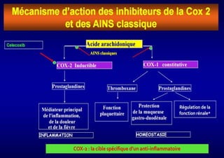 Anti-inflammatoires non stéroïdiens 