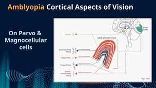 Amblyopia and Orthoptek as presented in AIOC 2022.pptx