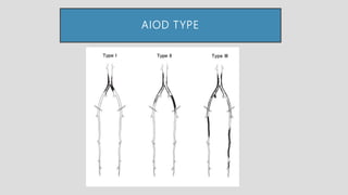 Aiod | PPTX