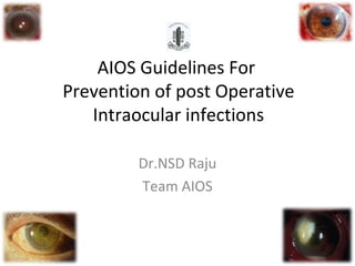 AIOS Guidelines For 
Prevention of post Operative 
Intraocular infections 
Dr.NSD Raju 
Team AIOS 
 