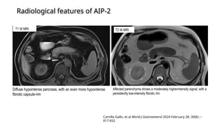 autoimmune pancreatitis 2025 by Dr aadhar.pptx
