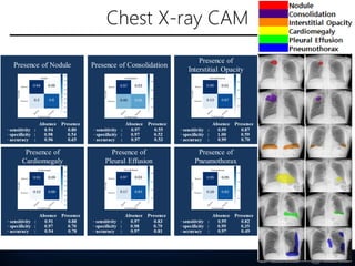 Chest X-ray CAM
 