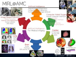 MIRL@AMC
Image Based Robotics
Biopsy/Tunneling
Artificial Joint Replacement/
Active Catheter
DBS Robot
Computer Aided Surgery
Human computer interface
Stereovision
Contactless Interface
Image guided
Surgery Planning
3D Printing/Navigation
Brain
Stroke
Parkinson
DBS planner, ECoG, BMI
Lung
COPD
DILD
Asthma
HT
Cardiac
CT Perfusion
4D Flow MRI
4DUS
LCX
Artificial Intelligence
For Medical imaging
Artificial Intelligence
Segmentation/Registration
Computer aided detection
Content based image retrieval
LAD
RCA
 