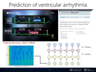 Prediction of ventricular arrhythmia
37
 