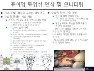 중이염 동영상 인식 및 모니터링
AMC ENT 정종우 교수님 협력연구
수술장 동영상 기술 개발
중이염, 인공와우 수술 동영상자료의 분류
수술영상을 각 단계로 분류 : 1000 례 이상
분류된 영상의 구조물 명시와 술식명시
시간축의 술식 예시
Cortical bone cutting & opening into mastoid
air cells
Sculpt the EAC: anterior boundary (optional)
Exposing the sigmoid sinus: posterior
boundary
Delineate mastoid tegmen: superior boundary
Open the antrum
Define and deepen the sinodural angle &
open the mastoid tip cells
Expose the incus from antrum
Facial nerve identification (mastoid segment)
Open the facial recess (posterior
tympanotomy
39
수술장 영상 기술 개발
영상 내 물체 인식의 경우
동영상 같은 경우에는 CNN과 RNN을 결합
한 CNN-RNN 모델 사용
동영상 데이터 학습을 통한 수술 단
계 분류 알고리즘
- 개발정리된 영상을 이용한 인공지능
학습 알고리즘 개발
- 좌우측과 다양한 형태의 유양동에 따
른 적용
- 알고리즘의 임상 검증 및 평가(수술단
계 및 정량화 정보)
 