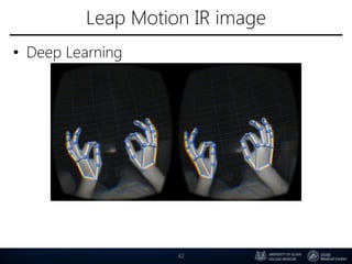 Leap Motion IR image
• Deep Learning
42
 